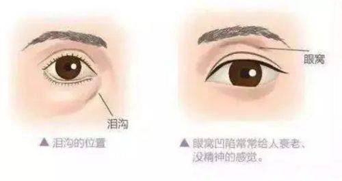 体验长沙中科皮肤病医院激光脱毛：专业团队护航，全程贴心体验，持久脱毛不是梦！ 