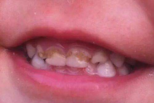 赣州丽齿健口腔诊所特色项目：