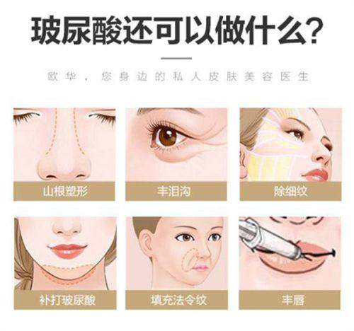 北京加减美拉皮价格表曝光！加减美V3价格1.7万起，加减美V9提升可高达19.9万