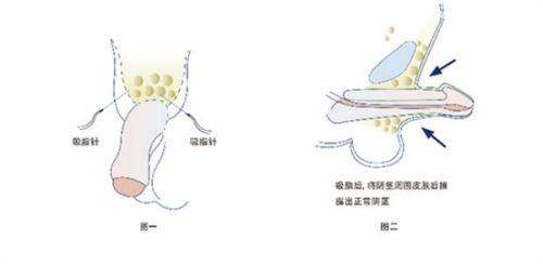 杭州市中医院（医疗美容科）