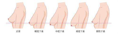 三、高性价比医美机构推荐指南