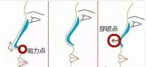 徐州心源美容医院特色项目：