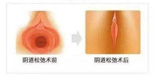上海诺诗雅2025年价格表参考