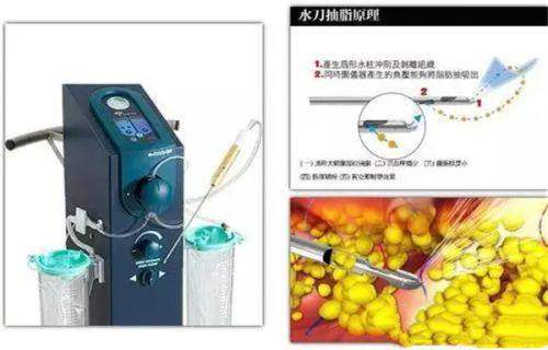四、2025济南玻尿酸注射价格参考