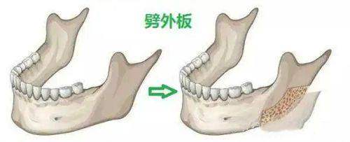 十周年庆优惠活动