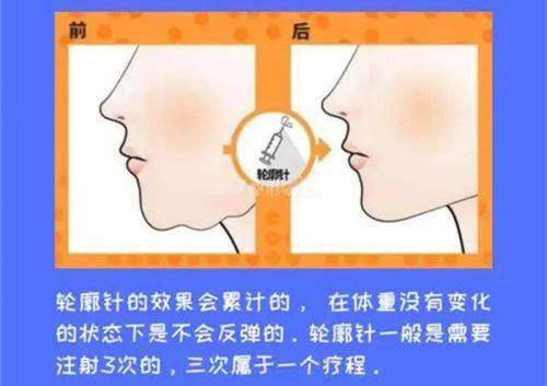 未来整形行业趋势与郑州巨星医疗美容诊所的发展