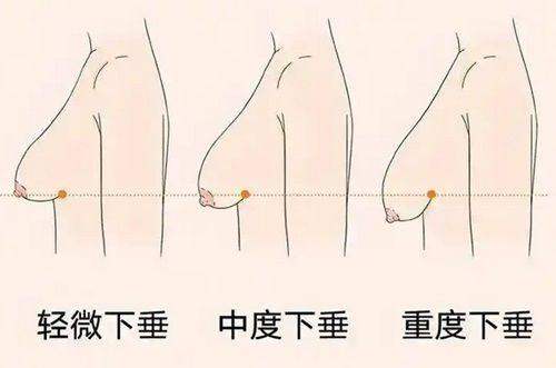 三、深圳美莱医院是哪个地铁站?周边公交配套详解