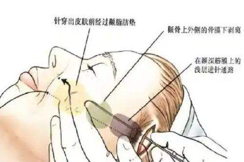 三、邯郸市人民医院整形美容科技术特色怎么样