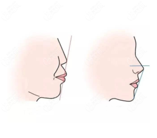 5. 郑州中原区中诺口腔树脂补牙之服务贴心