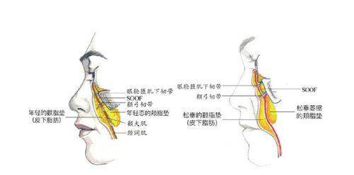 上海华美激光修复痘坑：多样的祛疤方式