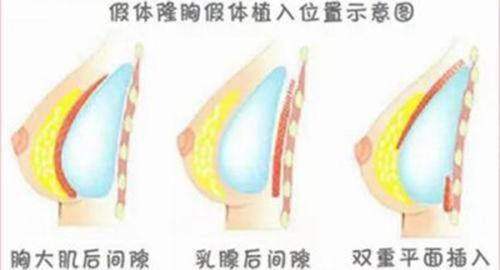 四、深圳大学总医院整形科怎么样？2025年全新价格参考