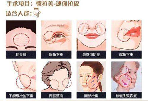 广州贞韩医疗美容门诊部植发科地址电话及营业时间：