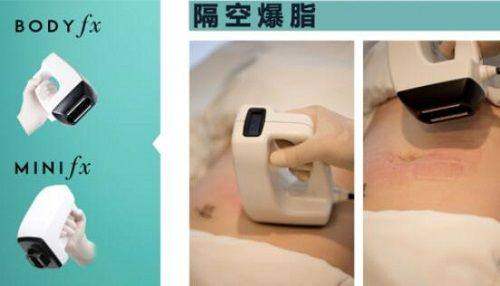 广州燕岭医院疤痕科正规吗？