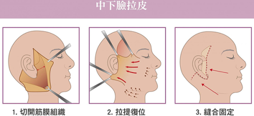西安叶子医疗美容医院正规吗?2025年终极解答