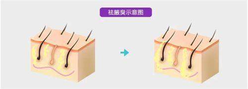 广州燕岭医院疤痕科地址电话及营业时间：