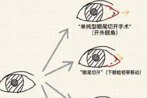 深圳景田医院3S人鱼体雕价格19800元起,万晓楠医生技术获好评