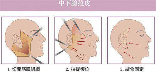 三、西安伊美尔口碑怎么样？服务优质，整形成效满意度高