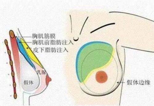 广州中科媄医疗美容医院口碑如何？