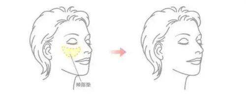 广州美咖医疗美容门诊部收费价格表：