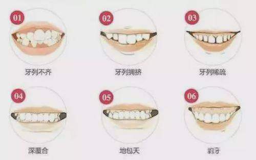 三、杭州口腔医院台州分院儿童齿科专长