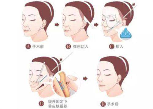 北京嘉德安美医疗美容门诊部预约挂号方式：