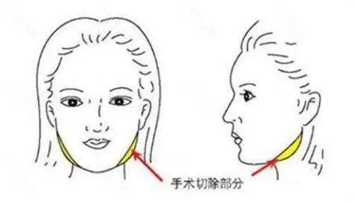 北京嘉德安美医疗美容门诊部口碑如何？