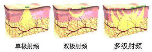 天津中 医 药大学第二附属医院（医疗美容科）口碑如何？