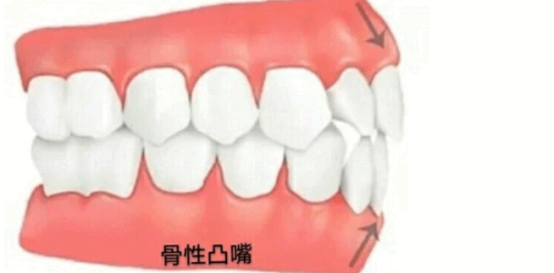 3. 四平诺雅口腔儿童窝沟封闭——严格的消毒流程