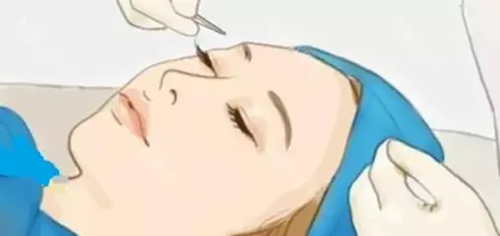 六、艾莉薇辉耀（Alyssence M）