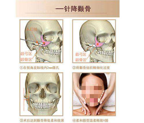 北京嘉德安美医疗美容怎么样？正规资质、优质技术与服务，口碑良好引众多爱美者！ 