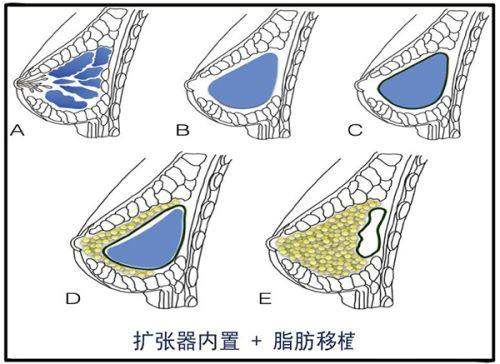 东莞爱思特医疗美容价格表曝光！双眼皮2980起，隆鼻7000起，变得更美不踩坑