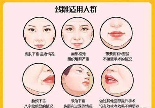 三、成都西区医院宋华敬抽脂真实实例追踪