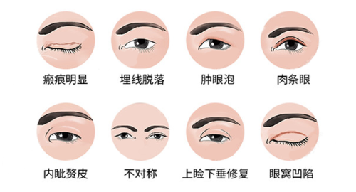 五、李广学医生去川字纹真皮填充技术实例展示——从“严肃脸”到“温柔相”的蜕变之路