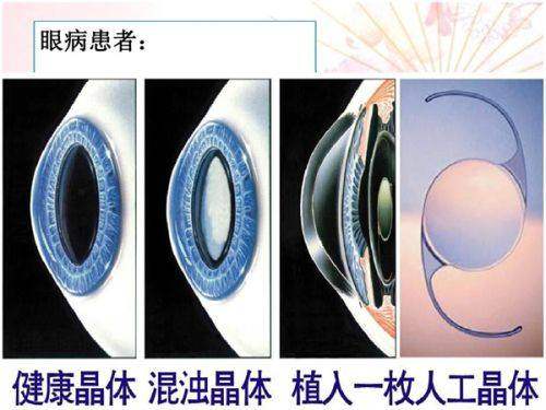 广州宸山医疗美容门诊部口碑如何？
