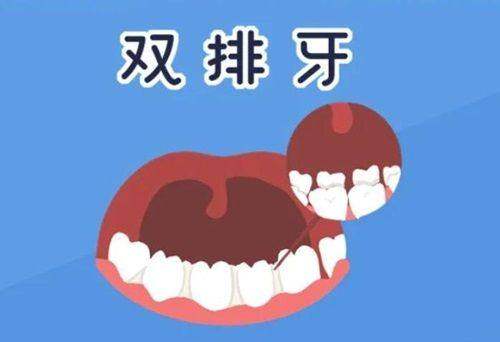 2025年九江中山口腔医院牙齿矫正费用：金属托槽7500元起，隐形矫正1.8万起