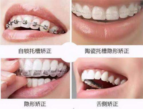 晋中小苹果口腔门诊部收费价格表：
