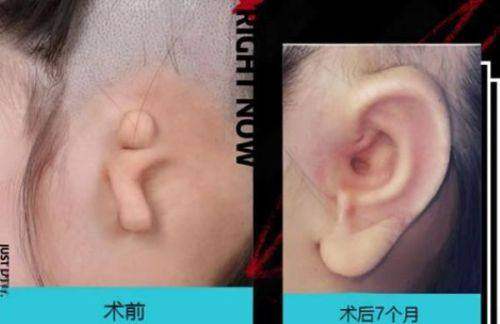 包头市中 心医院（医疗美容科）口碑如何？