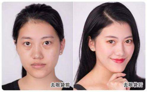 二、东莞壹加壹整形医院收费标准之影响因素