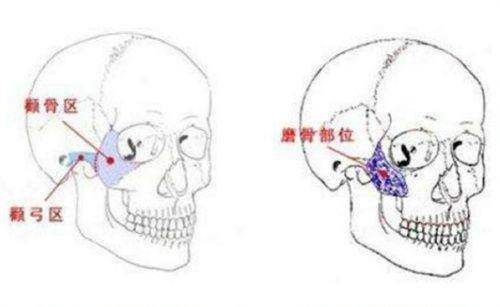 四、东莞缔美游定良医生