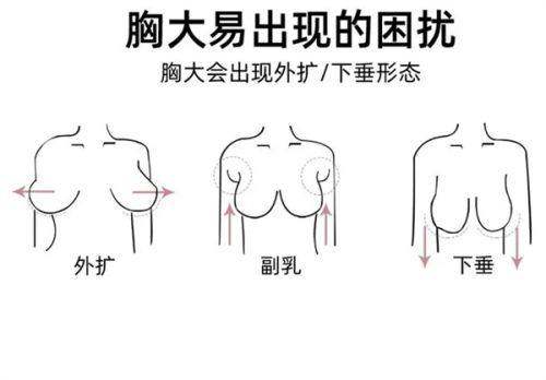 九、东莞叶子柯玉金医生