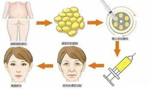 韩国ID整形医院口碑如何？