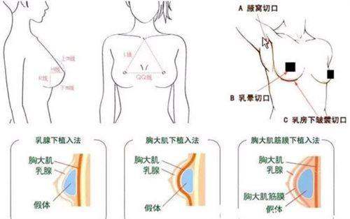 中国人民解放军第二五二医院 （医疗美容科）