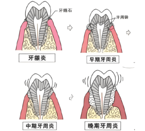 榆林斑鹿口腔门诊部收费价格表：