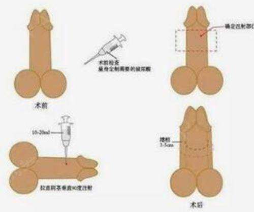 韩国必妩整形外科医院特色项目：