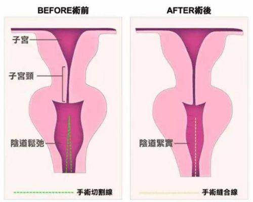 八、苏州紫馨美容医院——苏州美容整形医院排名前十的品质医美机构
