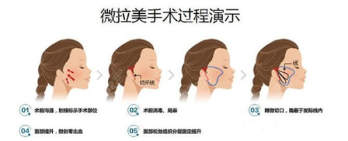 内蒙古科技大学第一附属医院（医疗美容科）