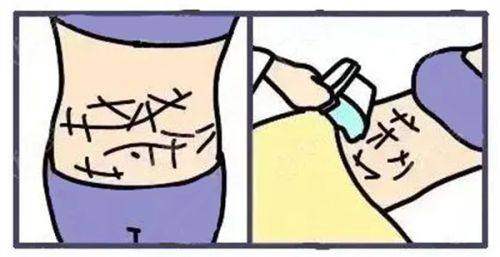 上海潘丽琴医生真实口碑评价：