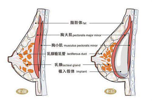 韩国丽丝整形外科医院收费价格表：
