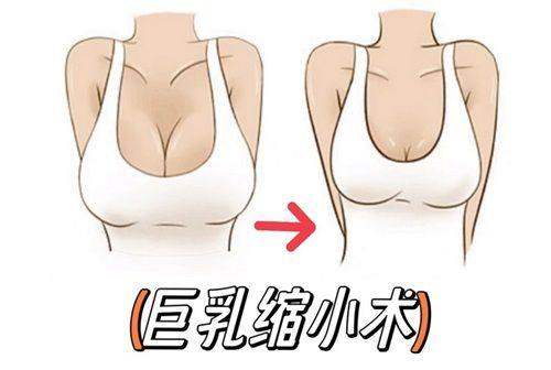 二、贵阳华医医院疤痕专科是正规医院吗——技术实力显优势