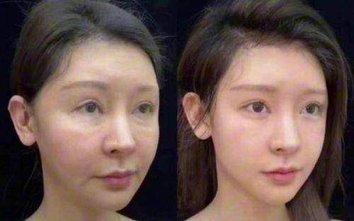 七、广州丽合医疗美容医院-广州伊妍仕少女针授权医院排名中的贴心之选
